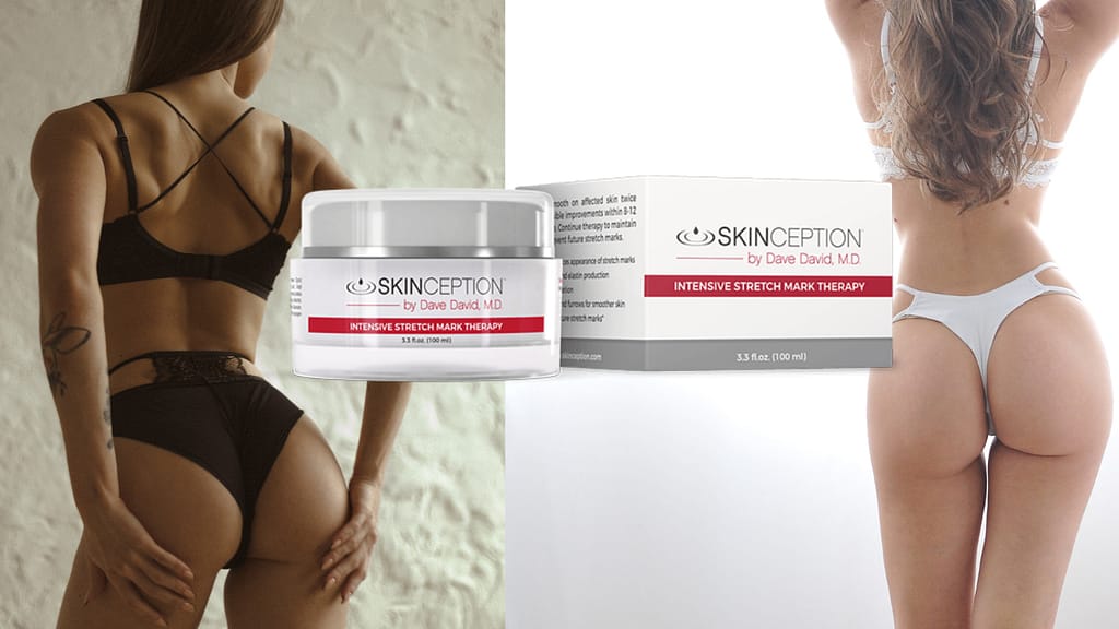 SkinCeption is a fantastic way to help fade those marks for good, giving you a younger-looking skin